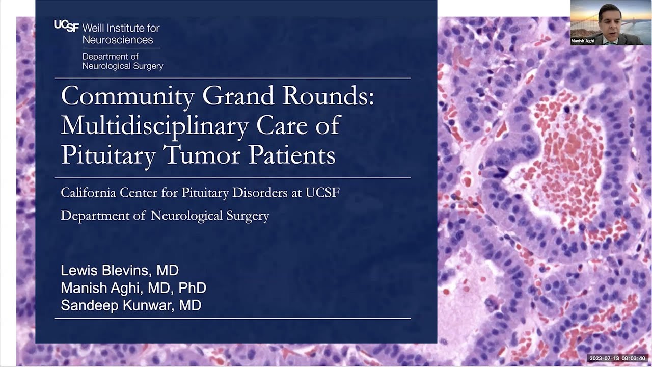 Multidisciplinary Care for Pituitary Tumor Patients | UCSF Community Grand Rounds