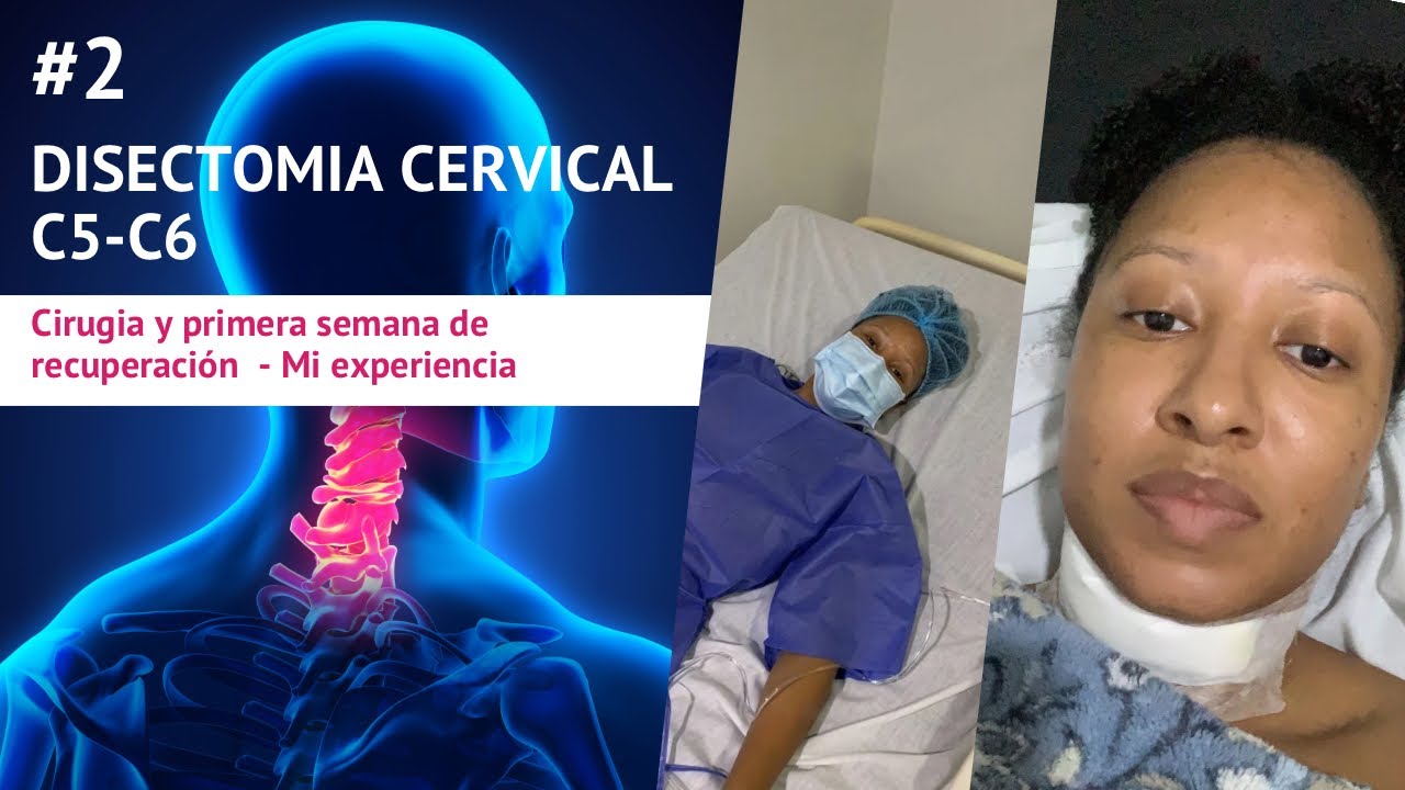 2- RECUPERACIÓN DE CIRUGÍA CERVICAL | PRIMERA SEMANA LUEGO DE QUITAR HERNIA EN C5-C6