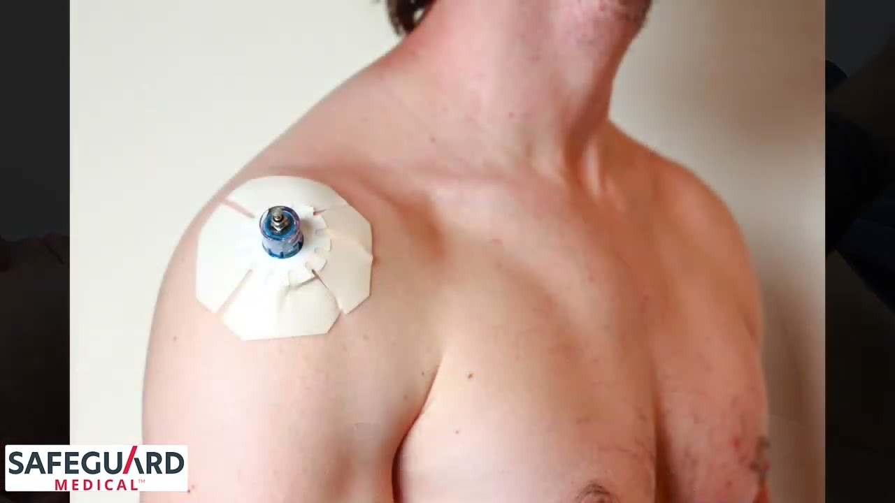 How to Safely Insert the NIO&trade; Adult IO Access Device In To the Humerus