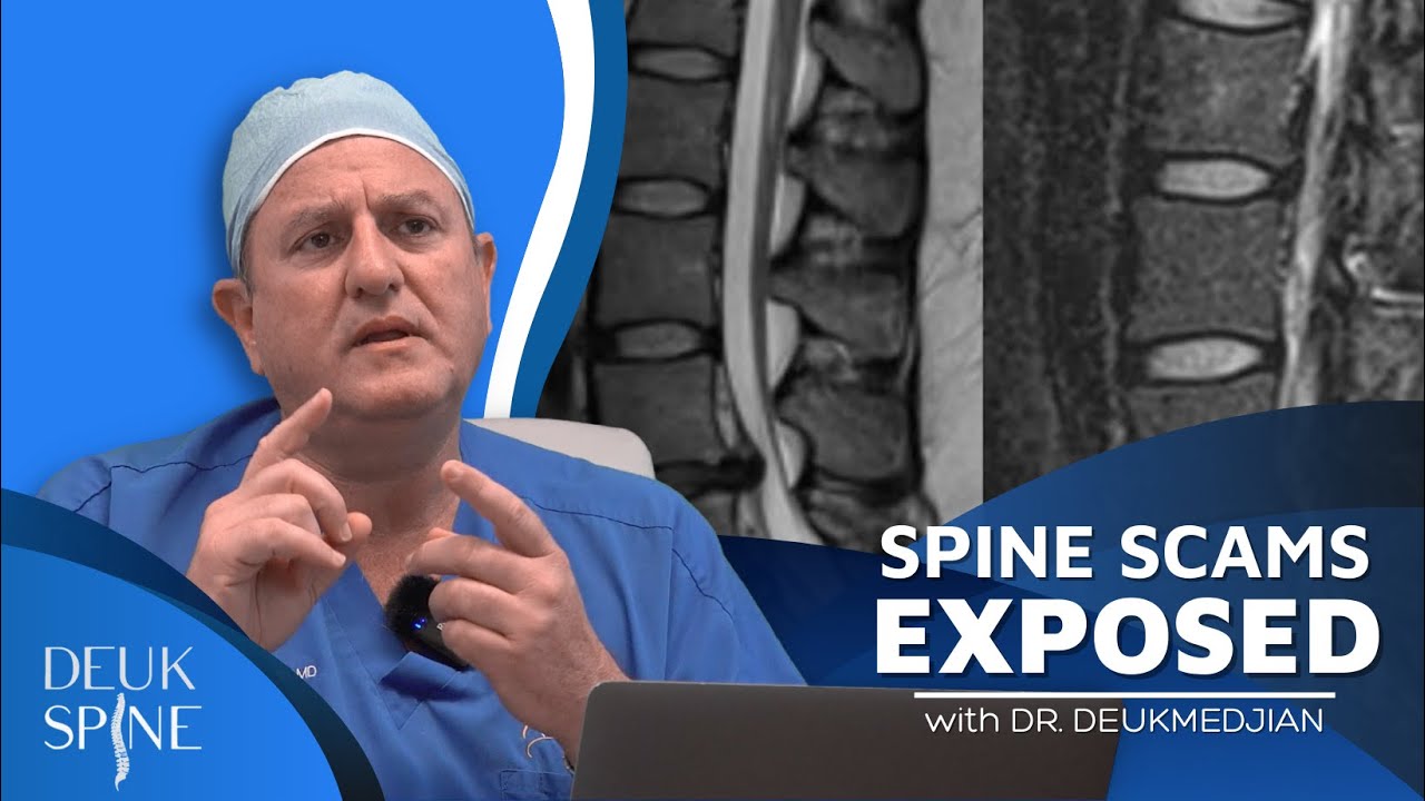 Spine Scams Exposed (Episode 1)