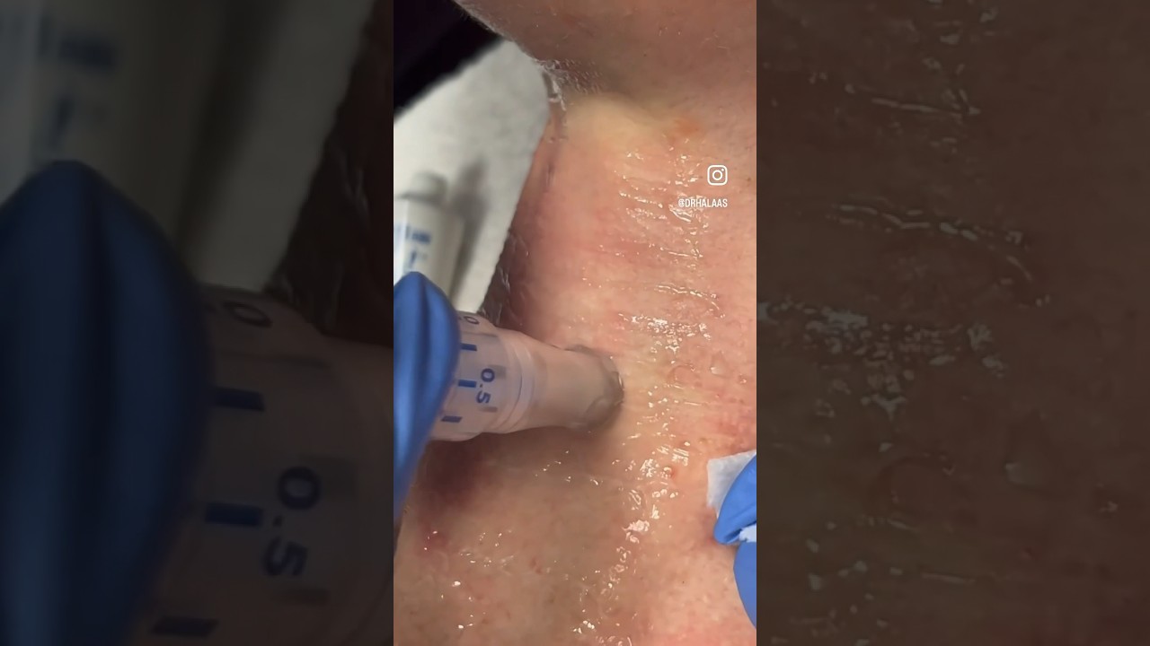 Let&rsquo;s talk about exosomes #skincare #exosomes #skinrejuvenation