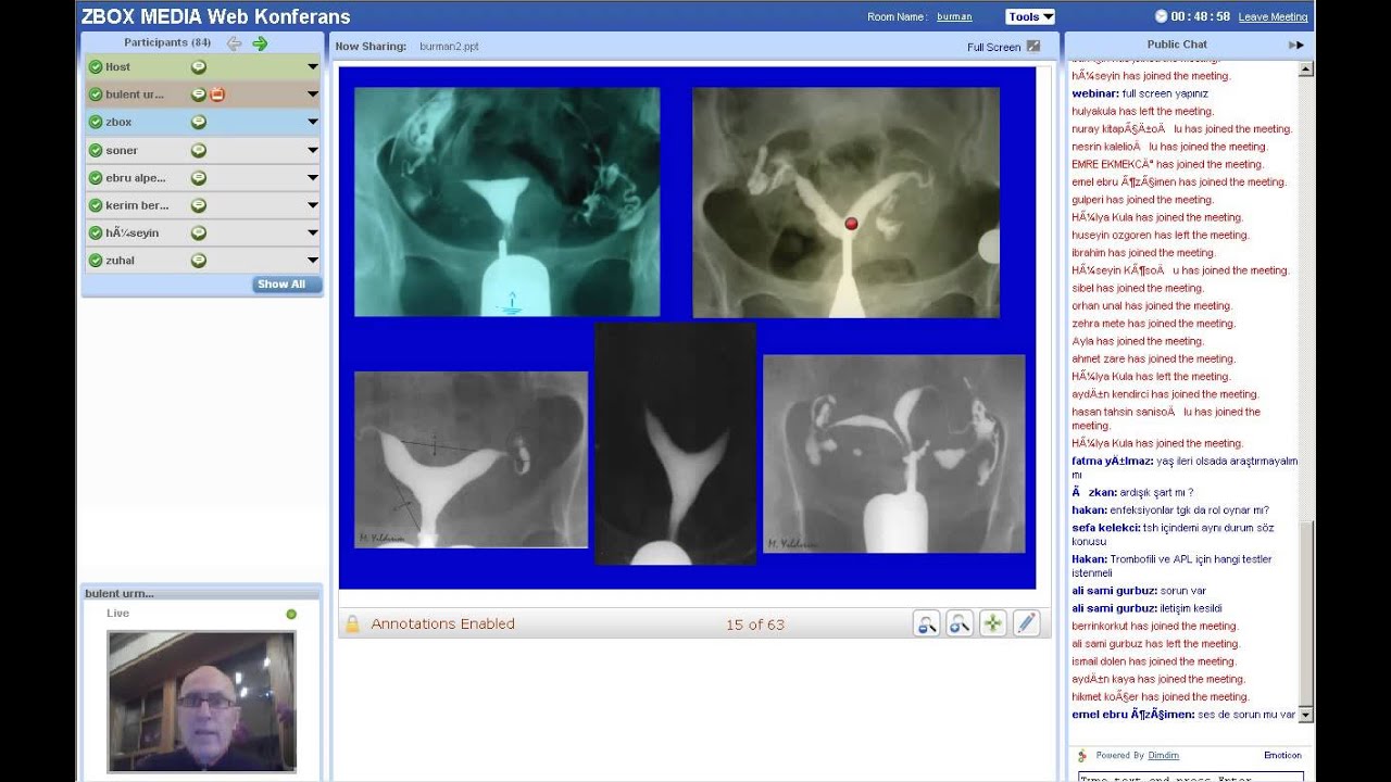 Tekrarlayan Gebelik Kayıpları Webinar Prof Dr Bülent Urman www.bulenturman.com