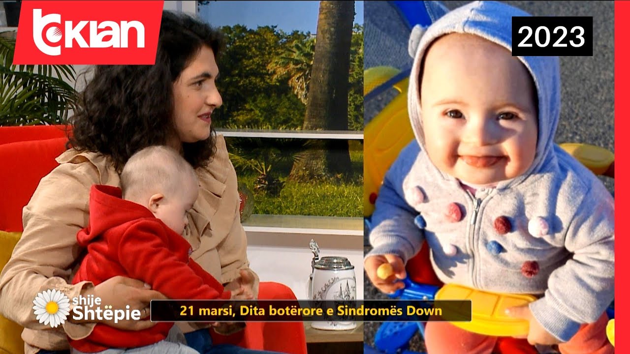 Dyshoi se e bija kishte sindromën Down:E kuptova kur e lava, nuk qante, qafën e kishte më të trashë…
