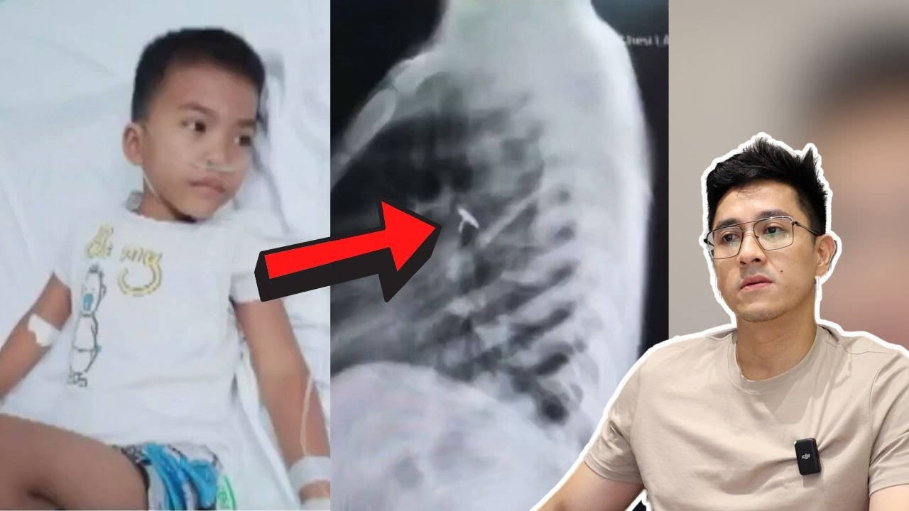 BATA, NAKALUNOK NG THUMBTACKS