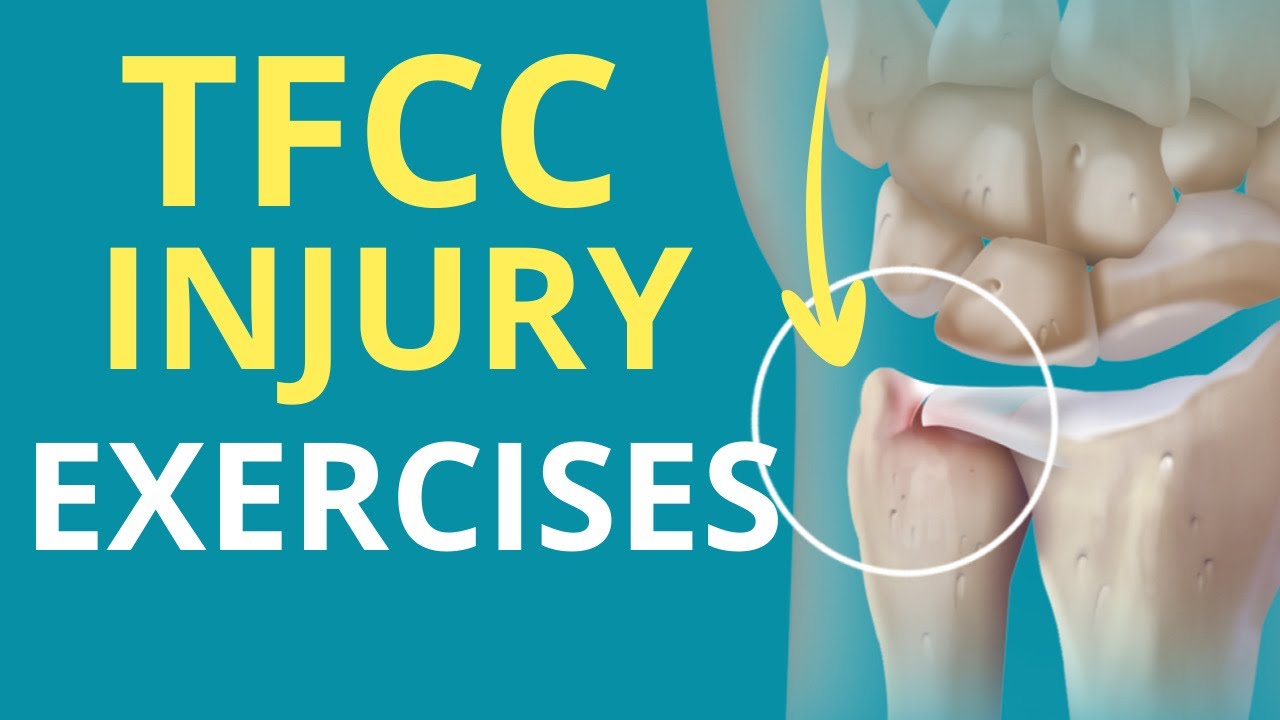 5 Exercises for a TFCC (Wrist) Injury