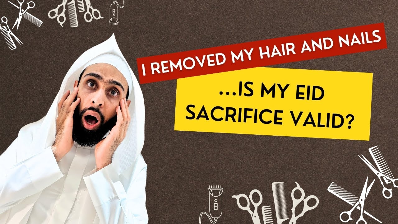 I removed my hair and nails...is my Eid sacrifice valid ? | Muthaffar Hashim