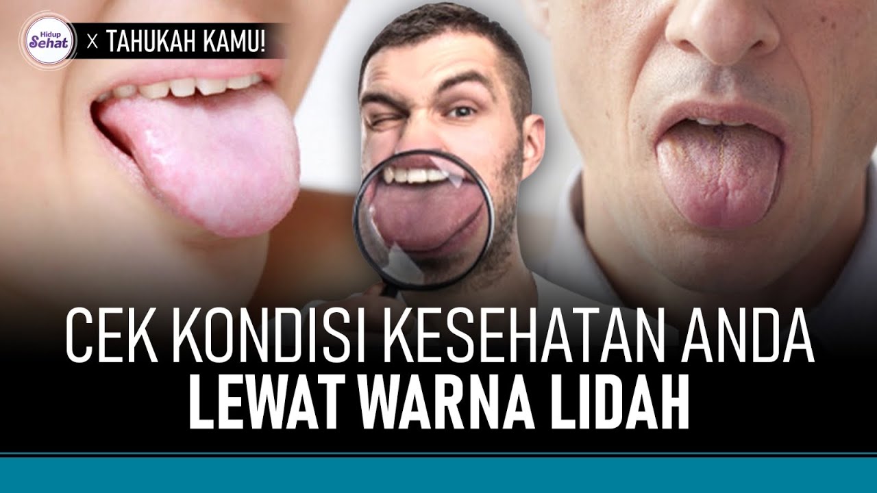 Cara Deteksi Penyakit Melalui Lidah, Hati-Hati Jika Berwarna Ungu! | Hidup Sehat tvOne