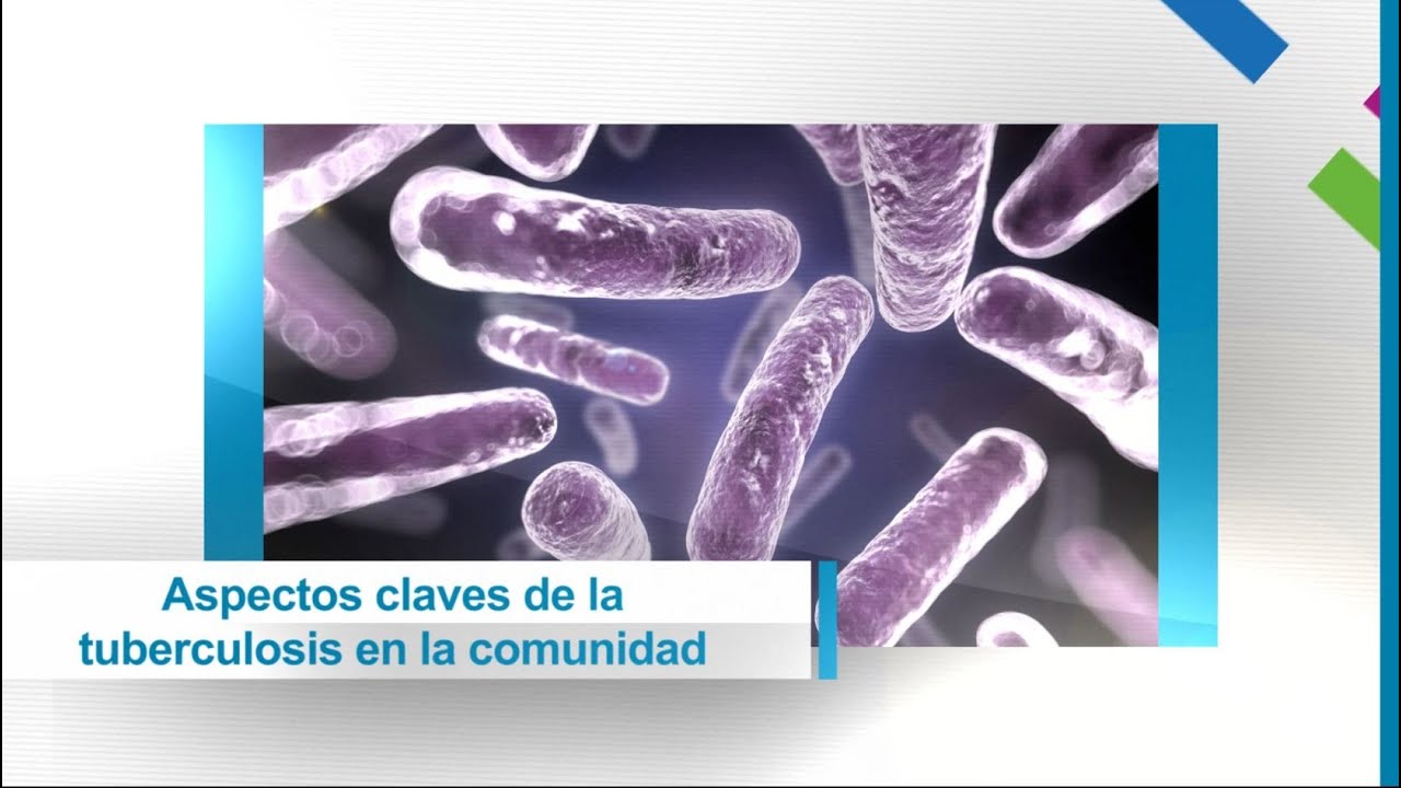 Aspectos claves de la tuberculosis en la comunidad