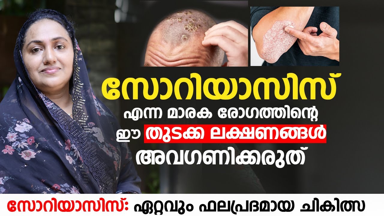 സോറിയാസിസ് എന്ന മാരക രോഗത്തിന്റെ ഈ തുടക്ക ലക്ഷണങ്ങൾ അവഗണിക്കരുത് |Dr Jannathul Firdouse Changampalli