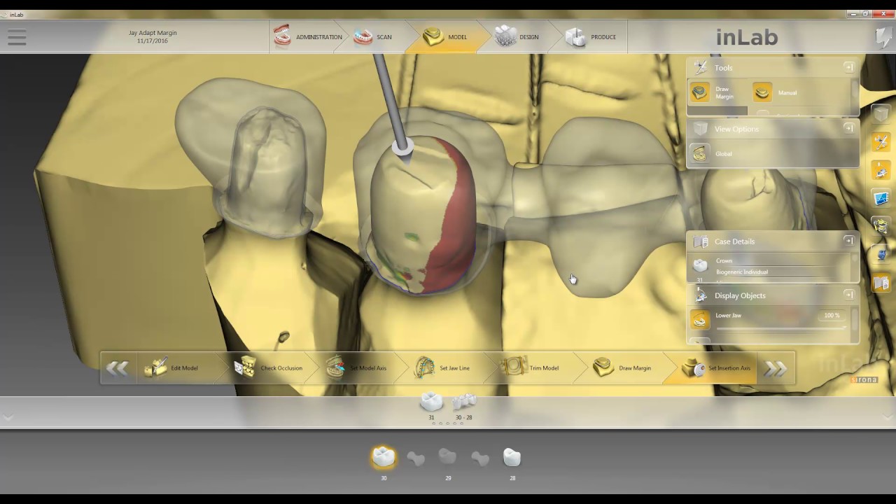 inLab SW 16 CAD and CAM Webinar