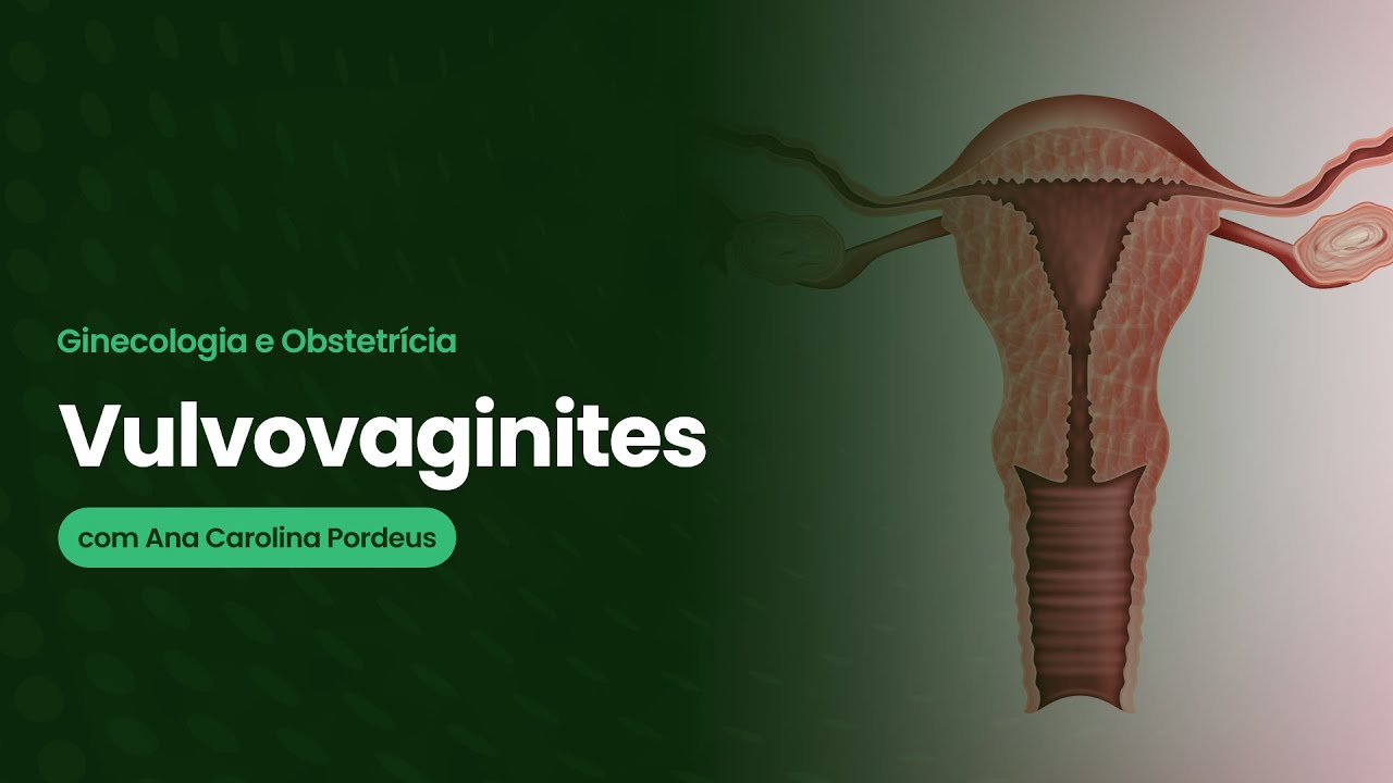 [ Residência Médica ] Ginecologia e Obstetrícia- Vulvovaginites