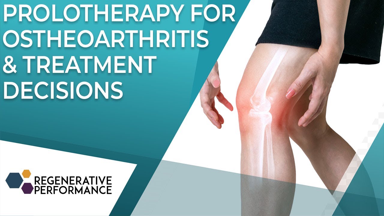 Prolotherapy for Osteoarthritis & Treatment Decisions