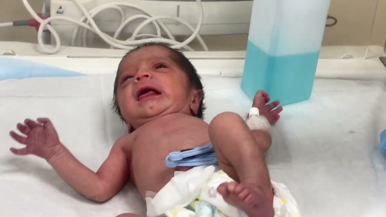 Cute 32-Week Preterm Baby Discharged Home | NICU Recovery Journey 🏡👶#babycare #feeding #mamalove 