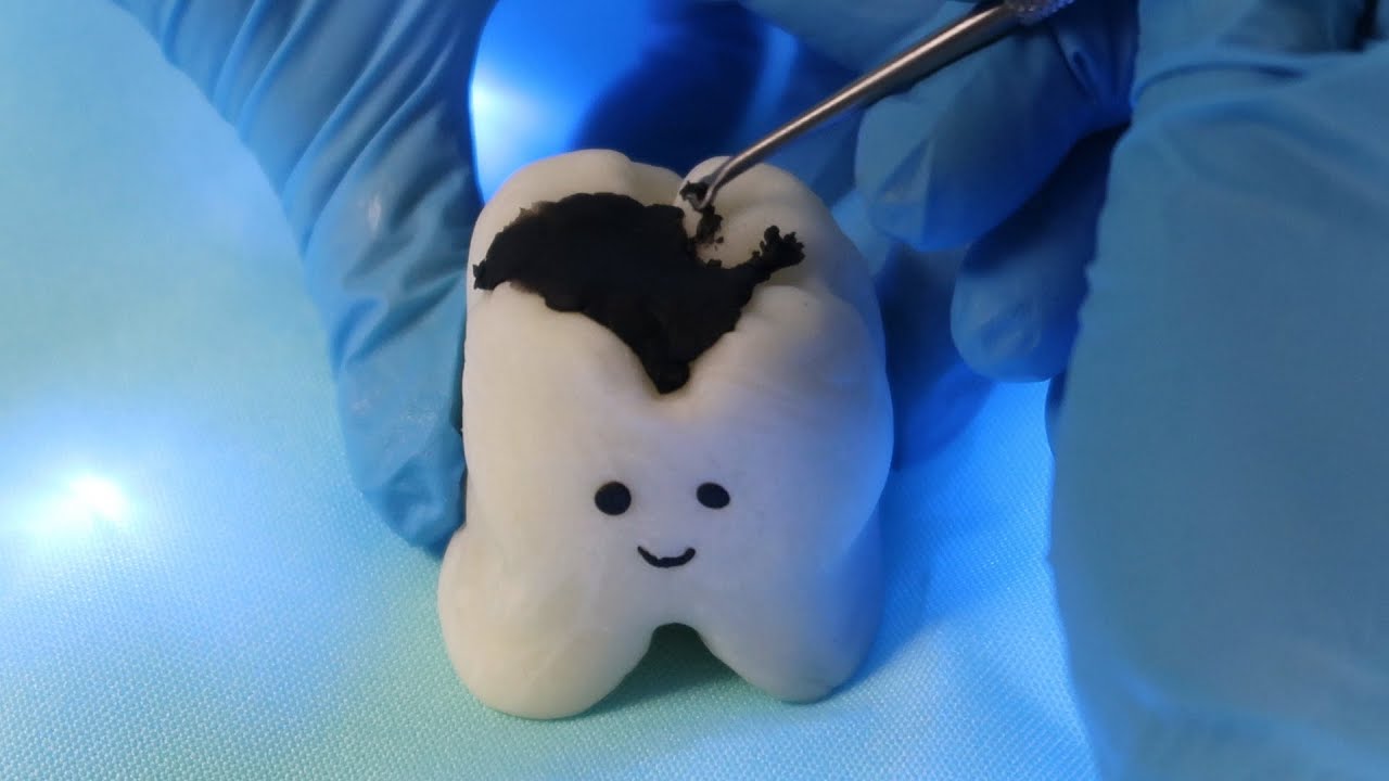 ASMR DENTISTA - LIMPANDO SEU DENTE! 🦷
