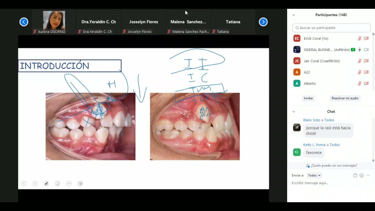 T de Burstone - Dr. Giancarlo Alfaro (22.07.22)