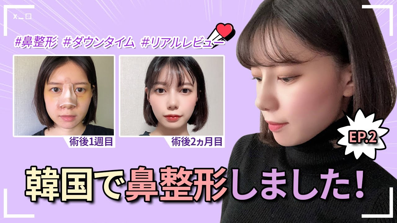 [鼻整形][DAテレビ]EP.2 韓国で鼻整形ダウンタイム、1ヵ月目になりました！