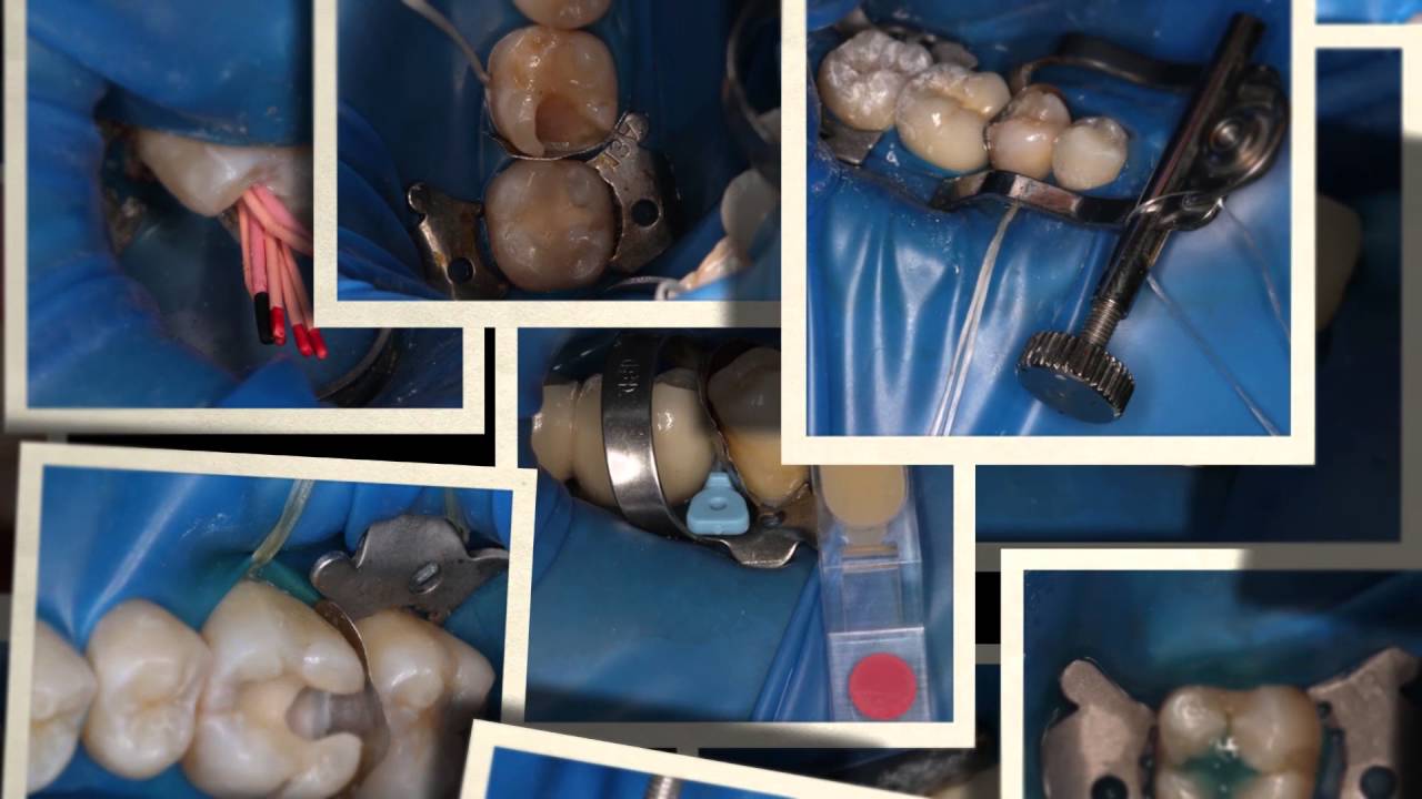 #Rubberdamology PROMO