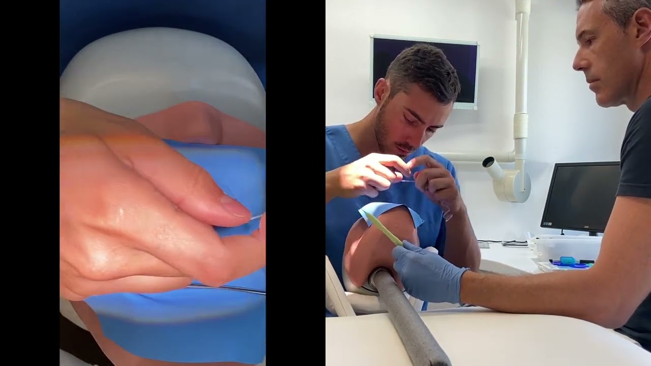 digue à 4 mains ADF2021