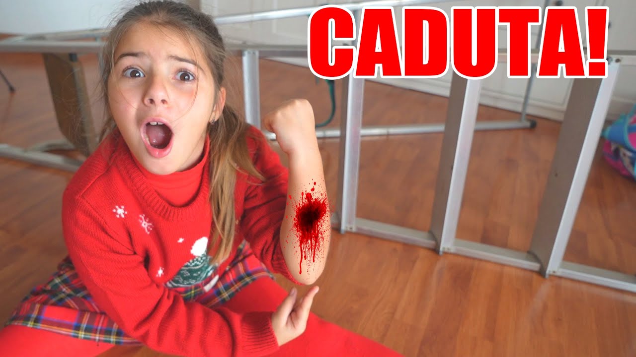 CLAUDIA E' CADUTA DALLA SCALA E SI FA MALE AL GOMITO