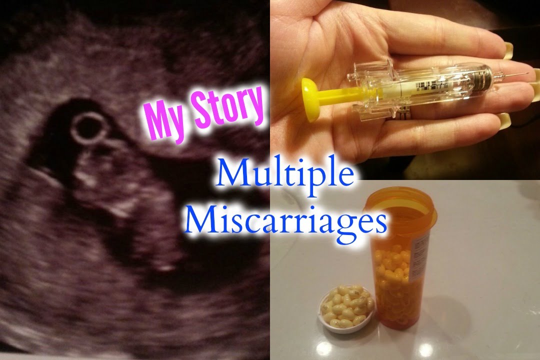 My Multiple Miscarriage Story - Overcoming Recurrent Pregnancy Loss