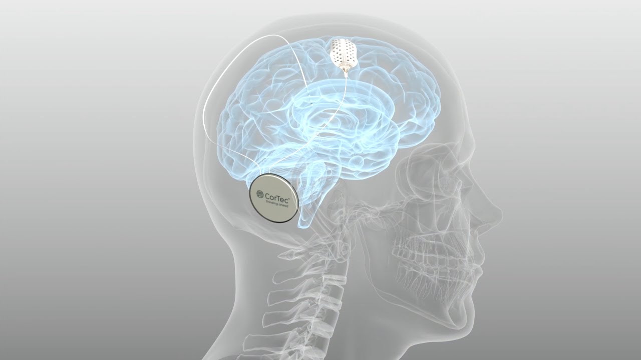 CorTec Brain Interchange System - Closed Loop Brain Computer Interface