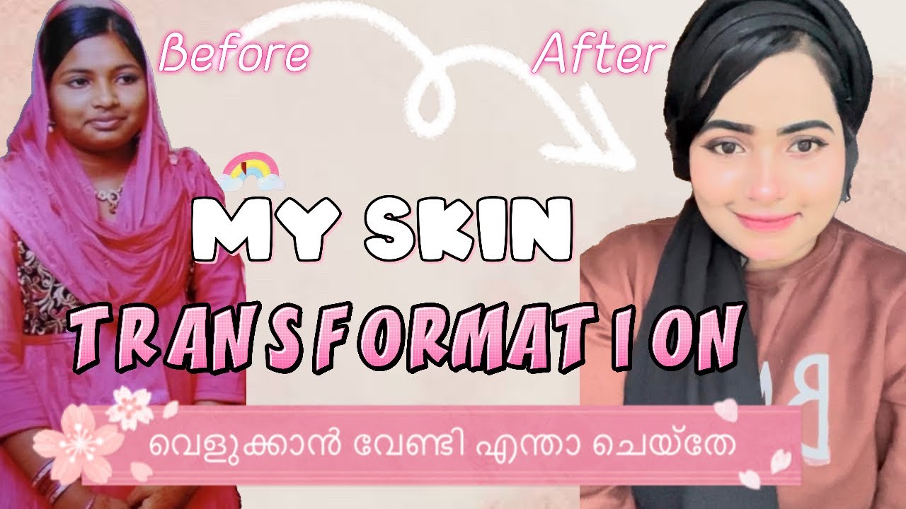 My skin transformation ✅💯skin brightening whitening cream❓|Malayalam|