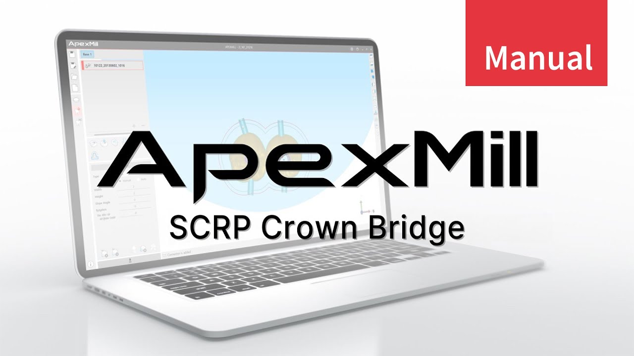 ApexMill_SCRP Crown Bridge (KR)