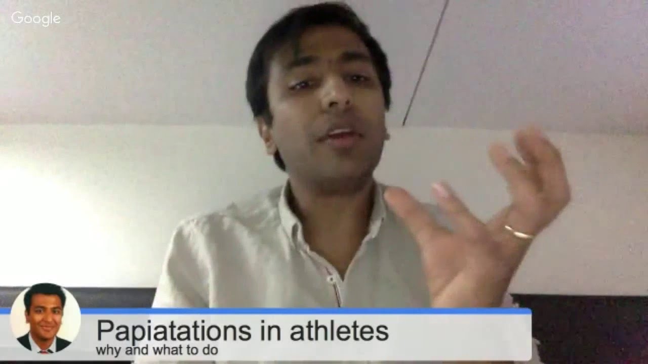 Palpitations in athletes - why and what to do about them