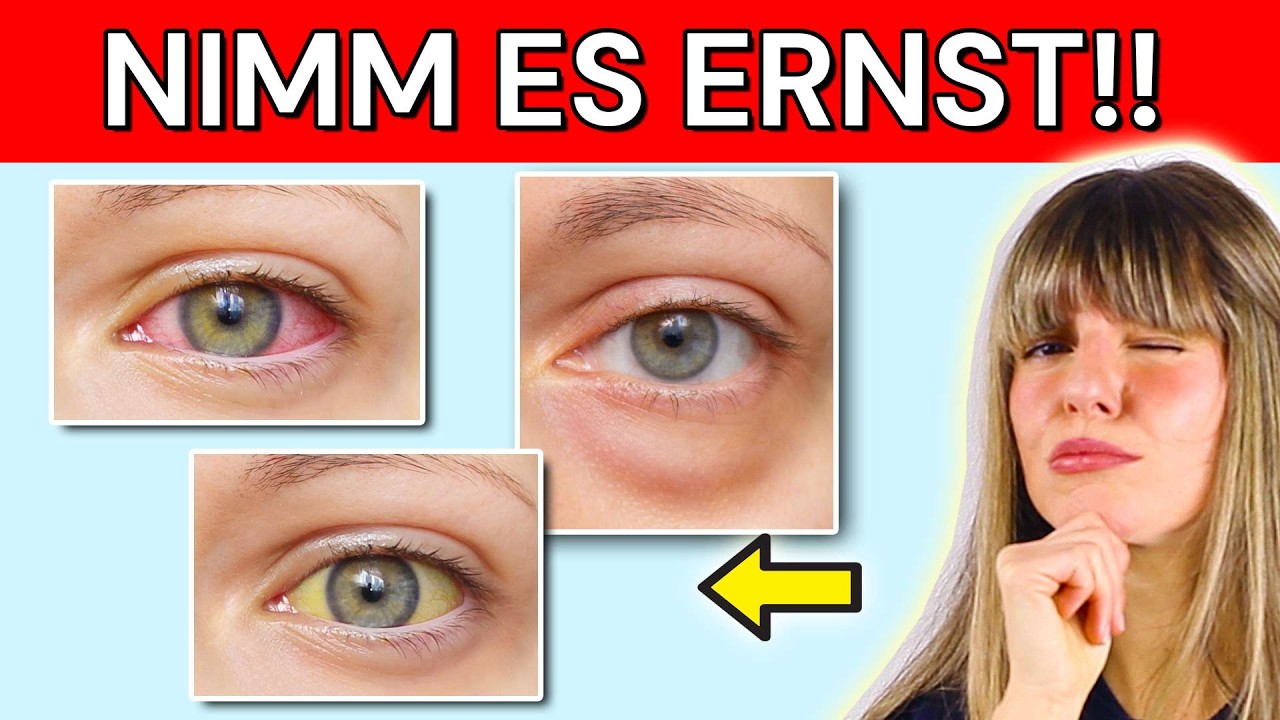 Das verraten deine Augen über deine Gesundheit (rote Augen, Bedeutung)