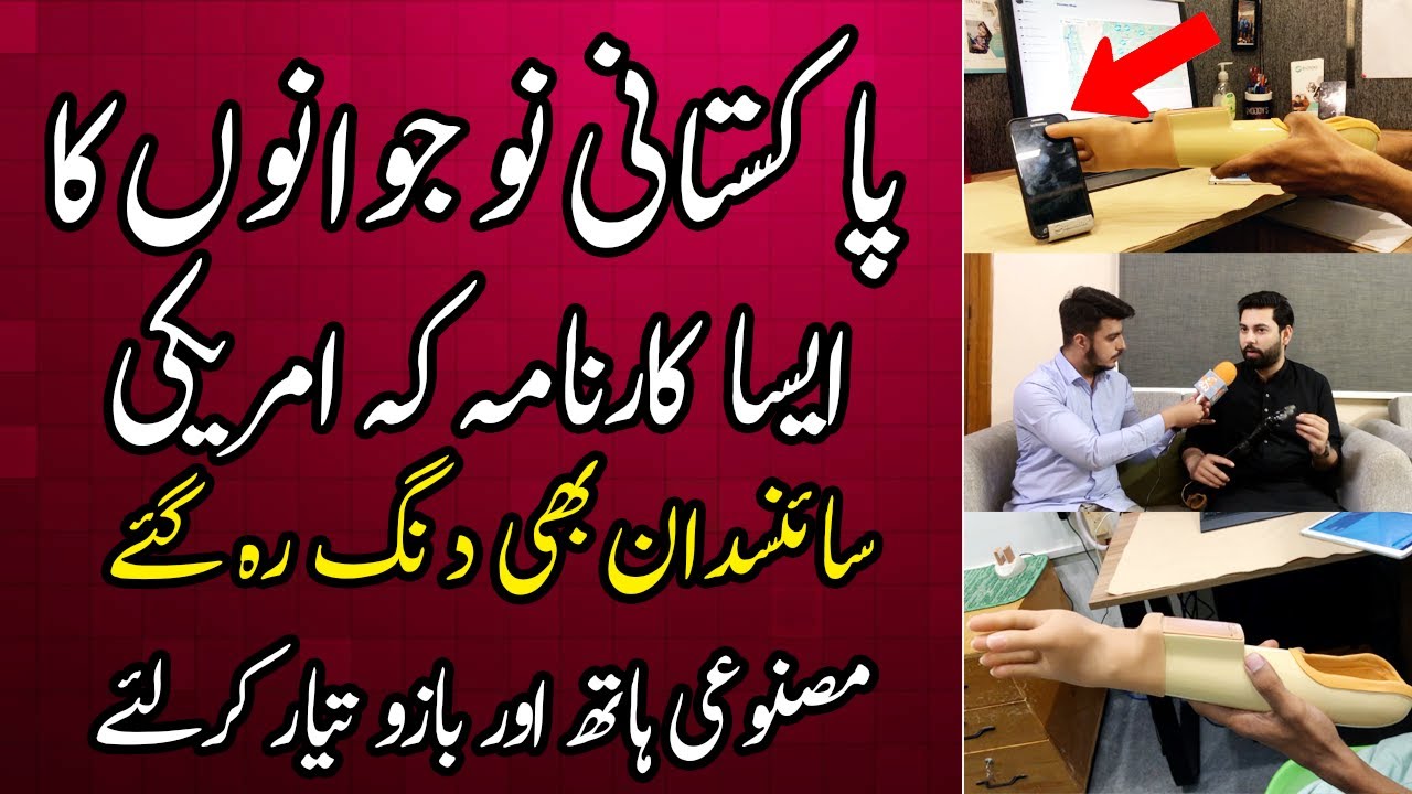 Pakistani Naujawano Ka Karnama Masnooi Hath Lagana ab Mumkin | Artificial Hand in Pakistan | GNN+