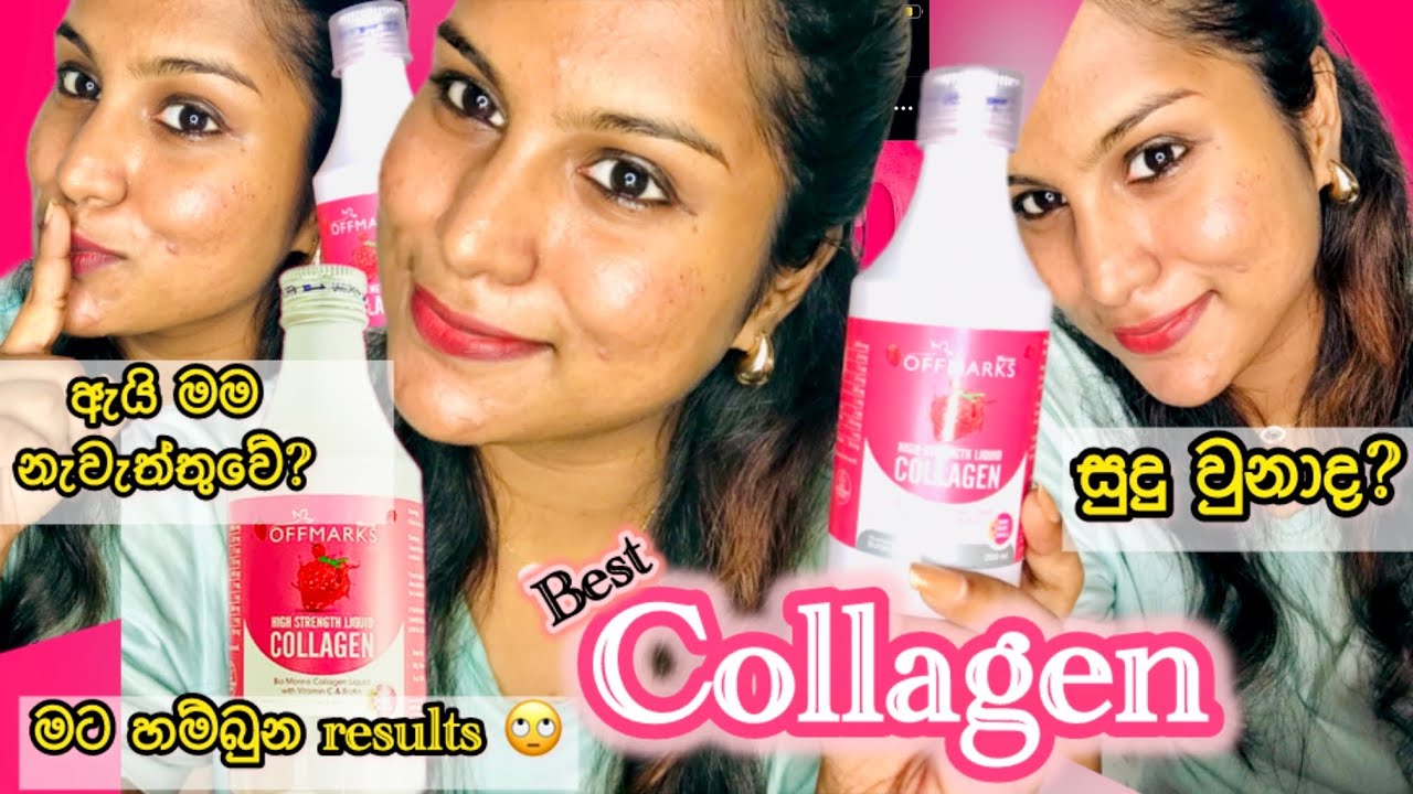 Offmarks collegen honest review | ඇයි මම නැවැත්තුවේ | results | #skincare#vlog#vlogger#visulifestyle