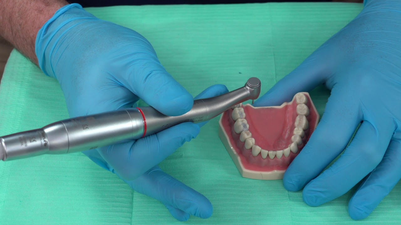 Оптимизация использования электрических наконечников