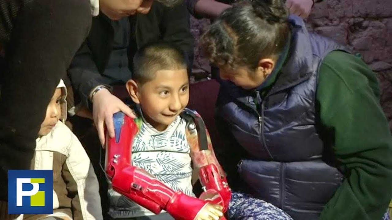 Ángel Gabriel, el niño que nació sin brazos ni piernas, ya tiene alas para volar