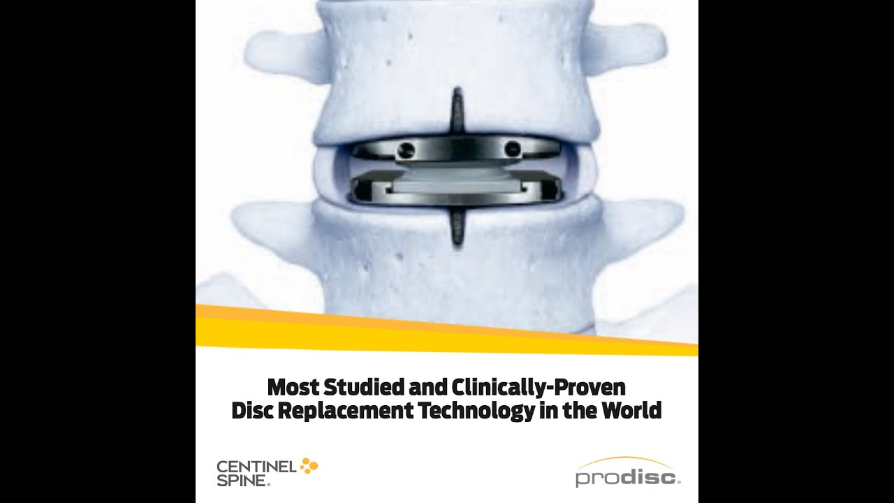 Centinel Spine: Why prodisc L ?