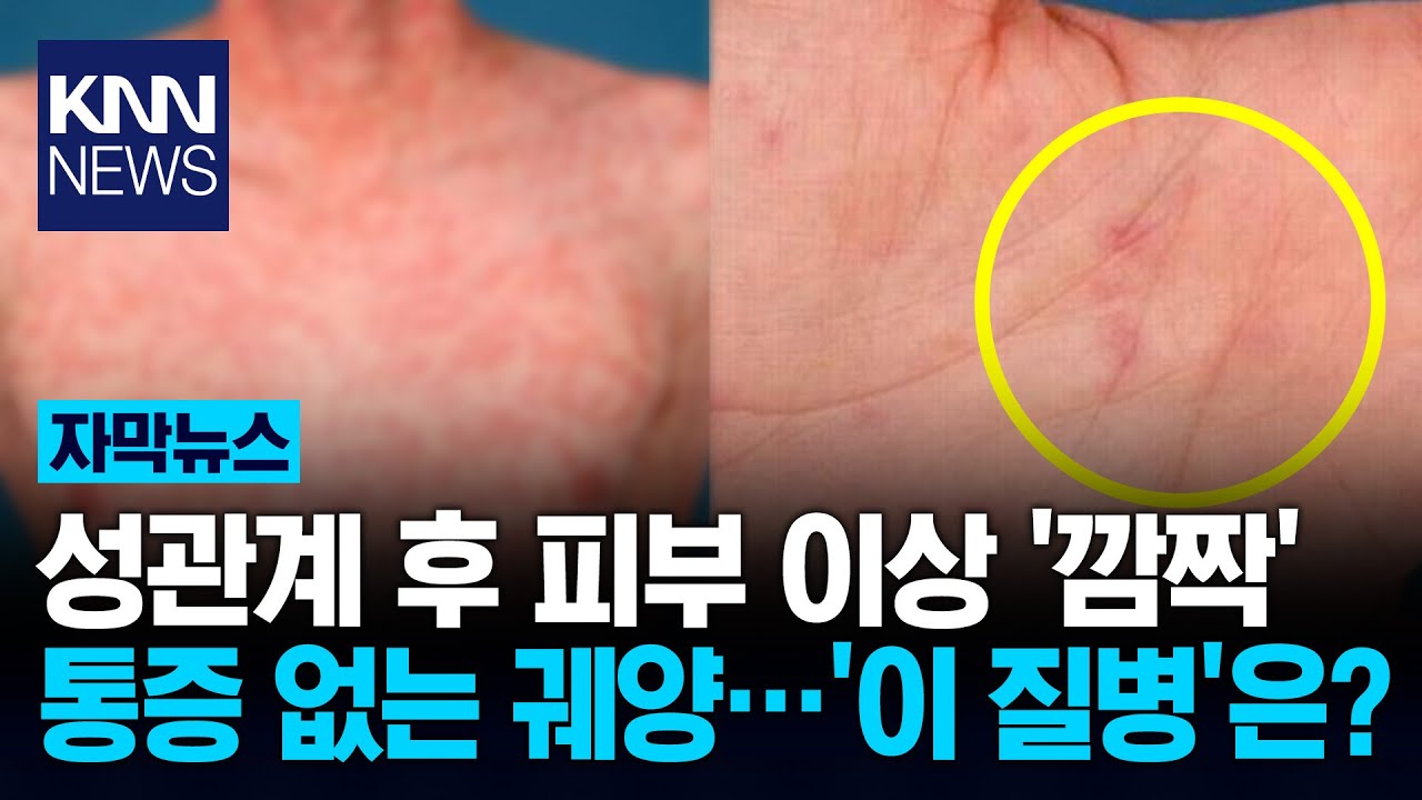성관계 후 온몸에 발진 '깜짝' 30대 남성 피부에 무슨 일이? / KNN