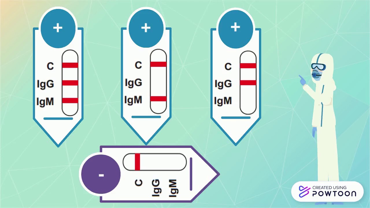 PCR vs Test r&aacute;pidos
