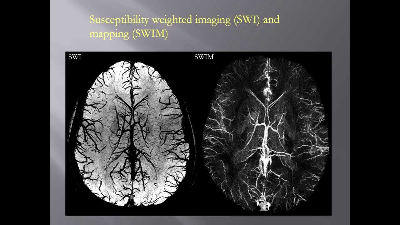 Imaging brain damage in TBI/clinical ramifications