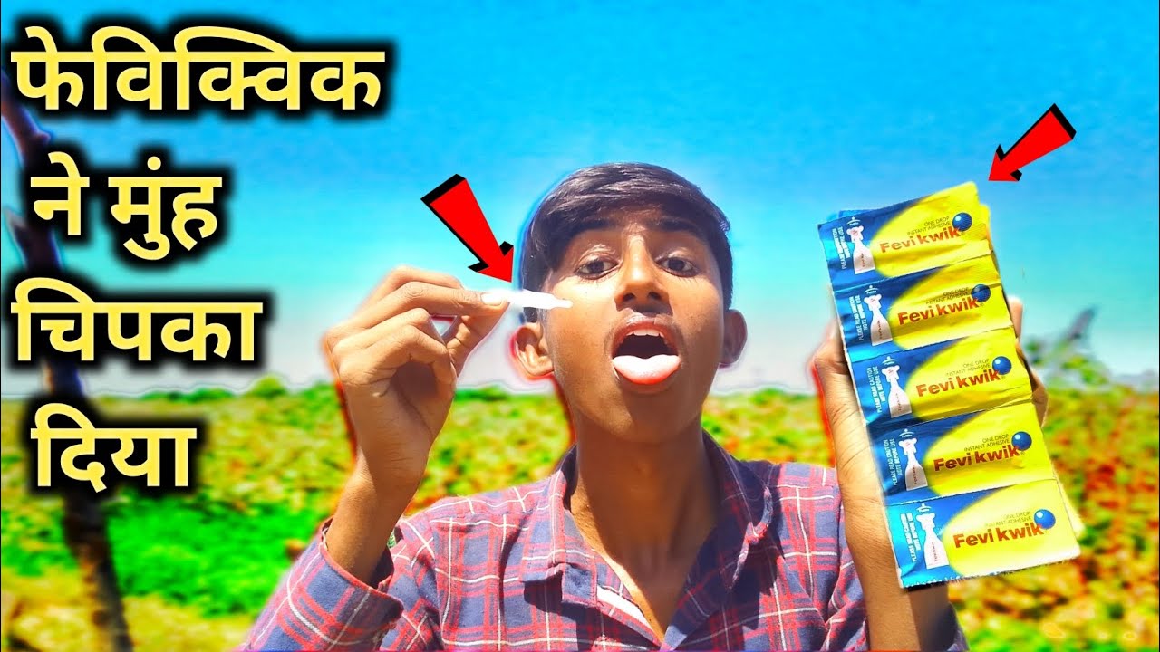 Fevikwik ने मुंह चिपका दिया 😧 | What If Eat Fevi Kwik in Mouth |shocking result 