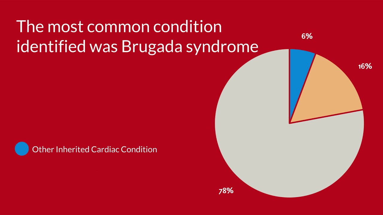 The Diagnostic Yield of Brugada Syndrome After Sudden Death With Normal Autopsy