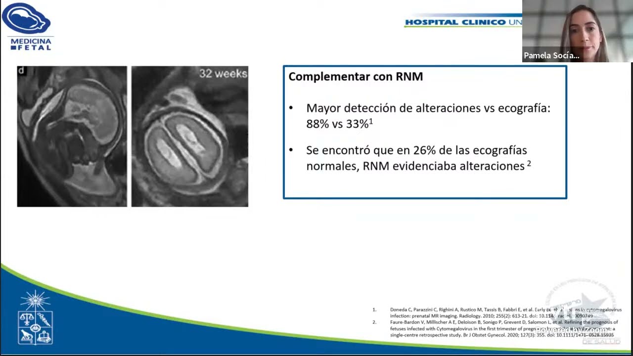 Guia CMV y toxoplasmosis y embarazo. 26 Jornada de MMF HCUCH