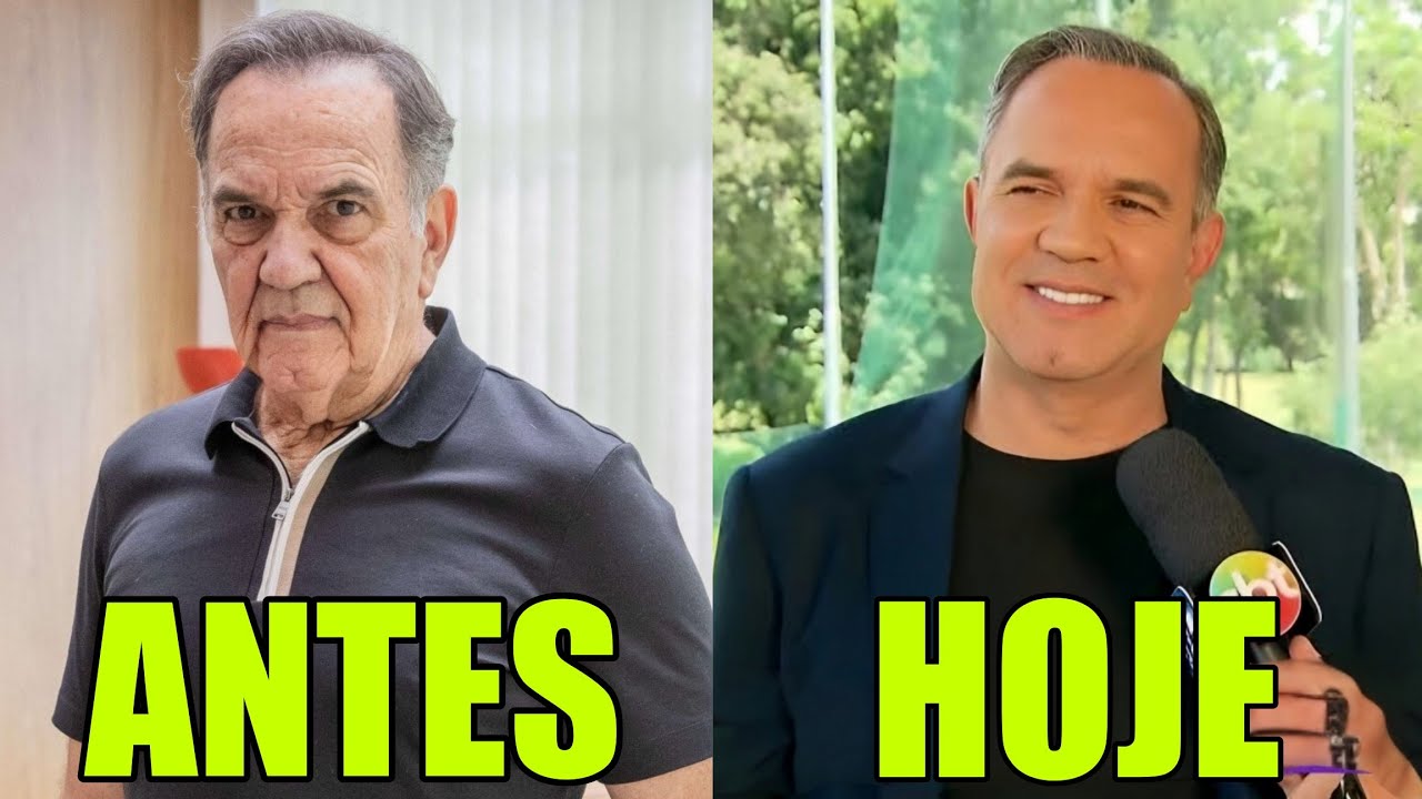 11 FAMOSOS QUE FIZERAM HARMONIZAÇÃO FACIAL e ESTÃO IRRECONHECIVEIS #15