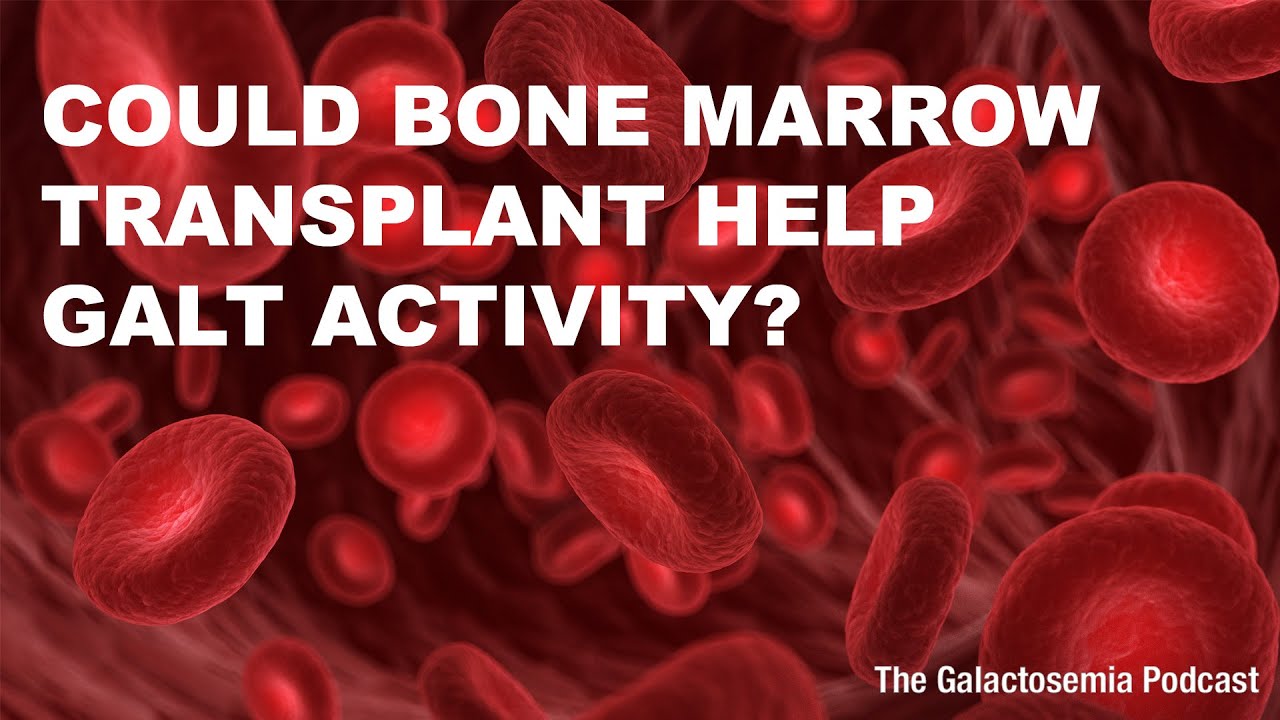 Exploring Bone Marrow Transplant in Galactosemia