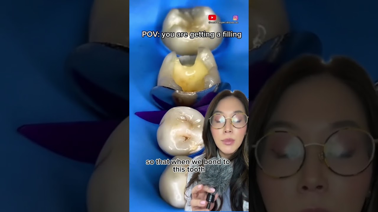 When fixing a cavity, here&rsquo;s how we make sure your teeth don&rsquo;t stick together. #cavity #filling