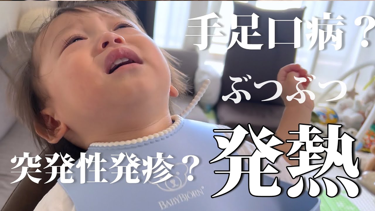 【1歳3ヶ月】突然40℃の発熱…まさかの手足口病？ご飯も食べられなくて大変でした💦