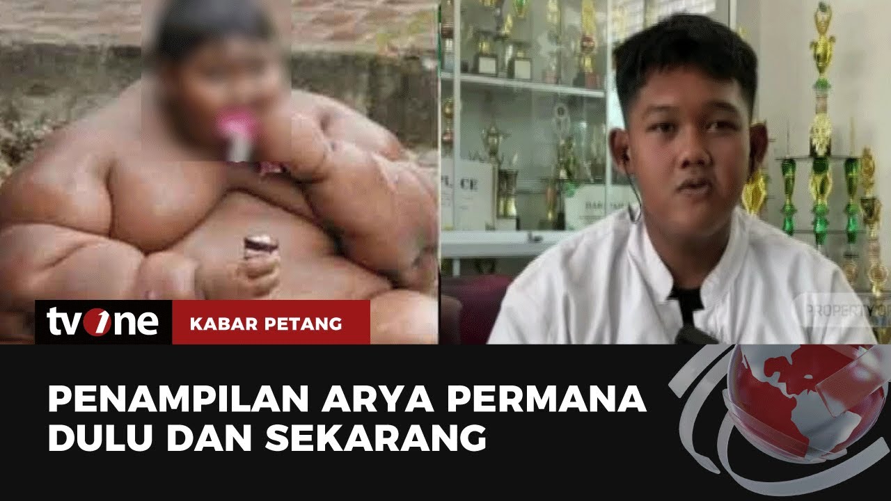 Masih Ingat Arya Bocah Obesitas? Begini Sekarang Kondisinya | Kabar Petang tvOne