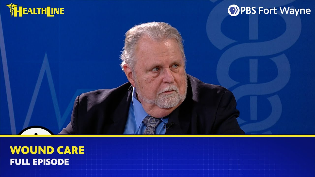 Wound Care: Prevention and Healing with Dr. James Edlund | HealthLine | PBS Fort Wayne