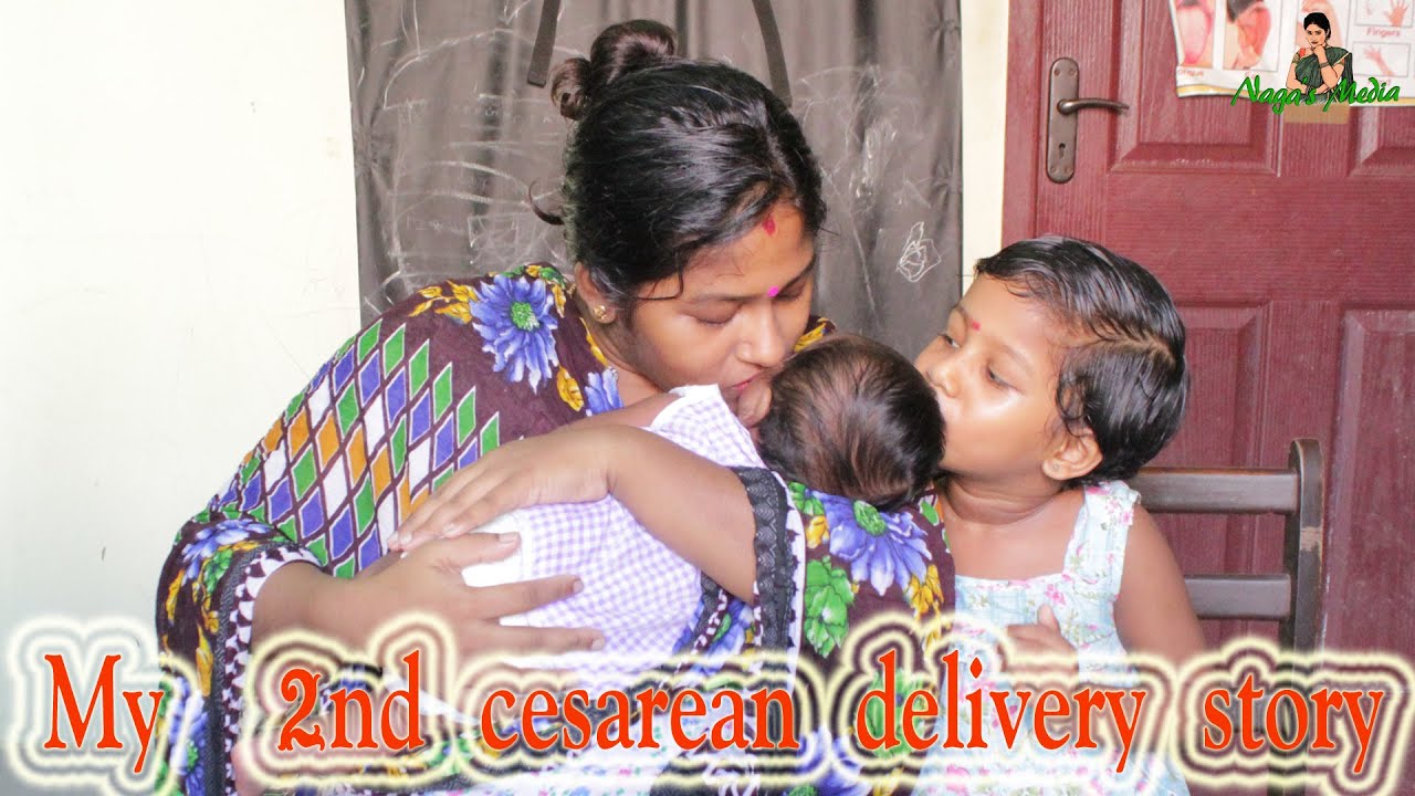 My  cesarean delivery story  / My pregnancy story  / C section delivery / My 2nd delivery story