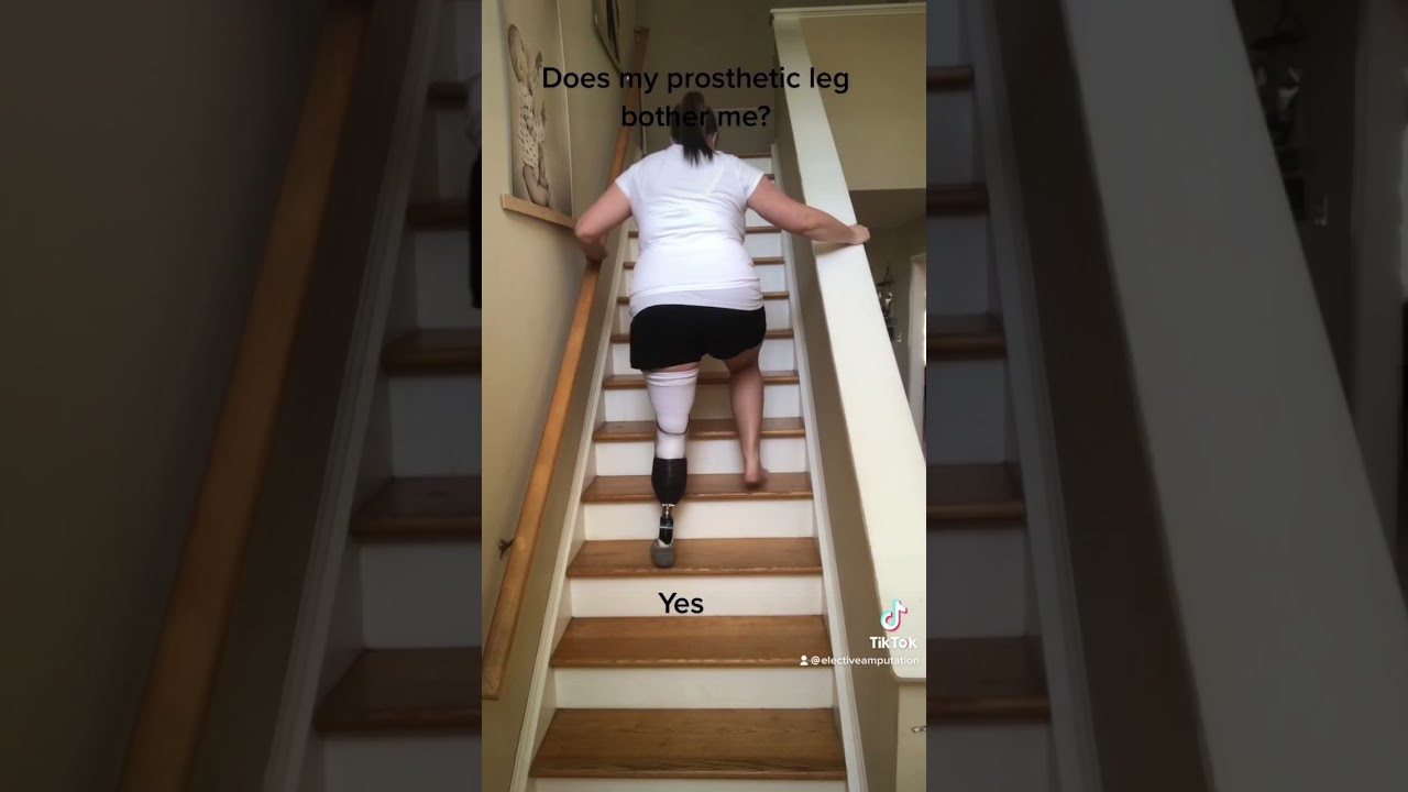 Does My Prosthetic Leg Bother Me?