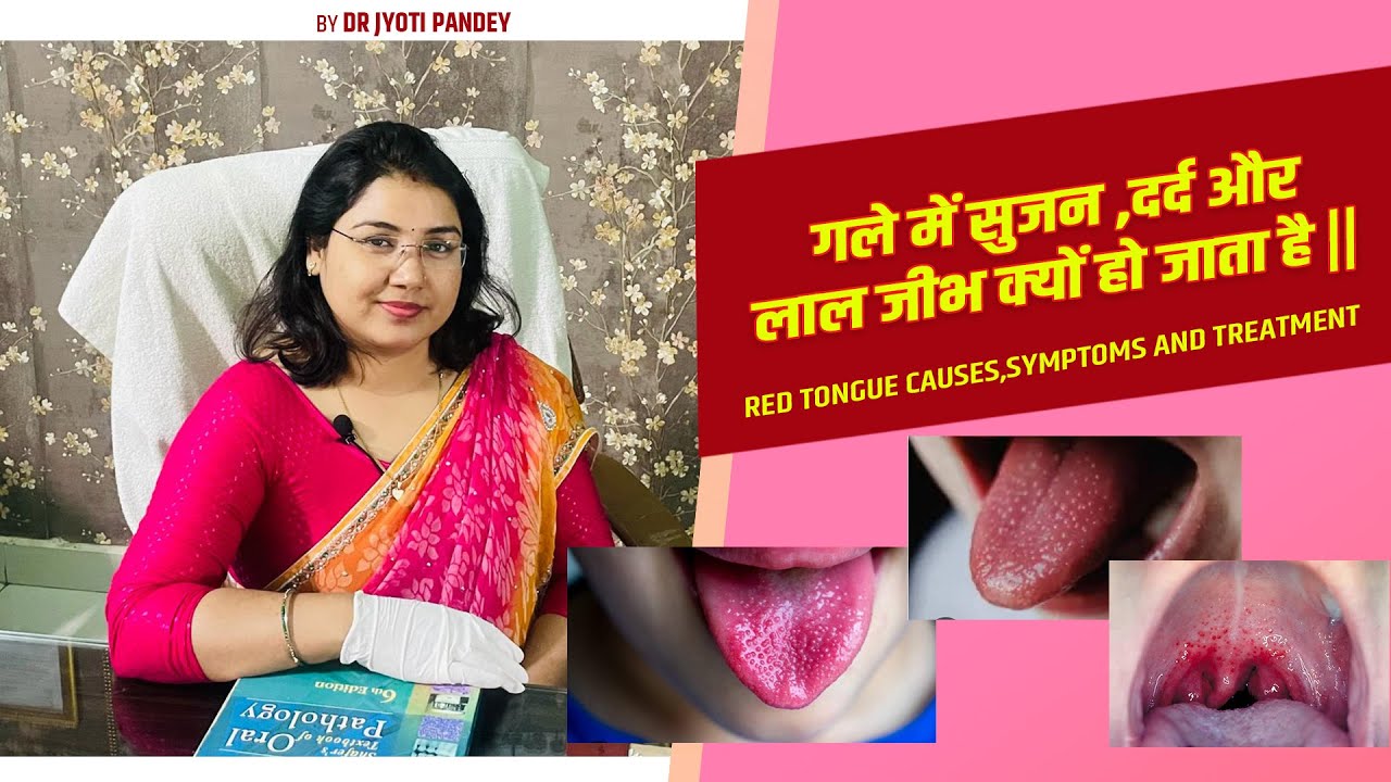 गले में सुजन ,दर्द और लाल जीभ क्यों हो जाता है ||