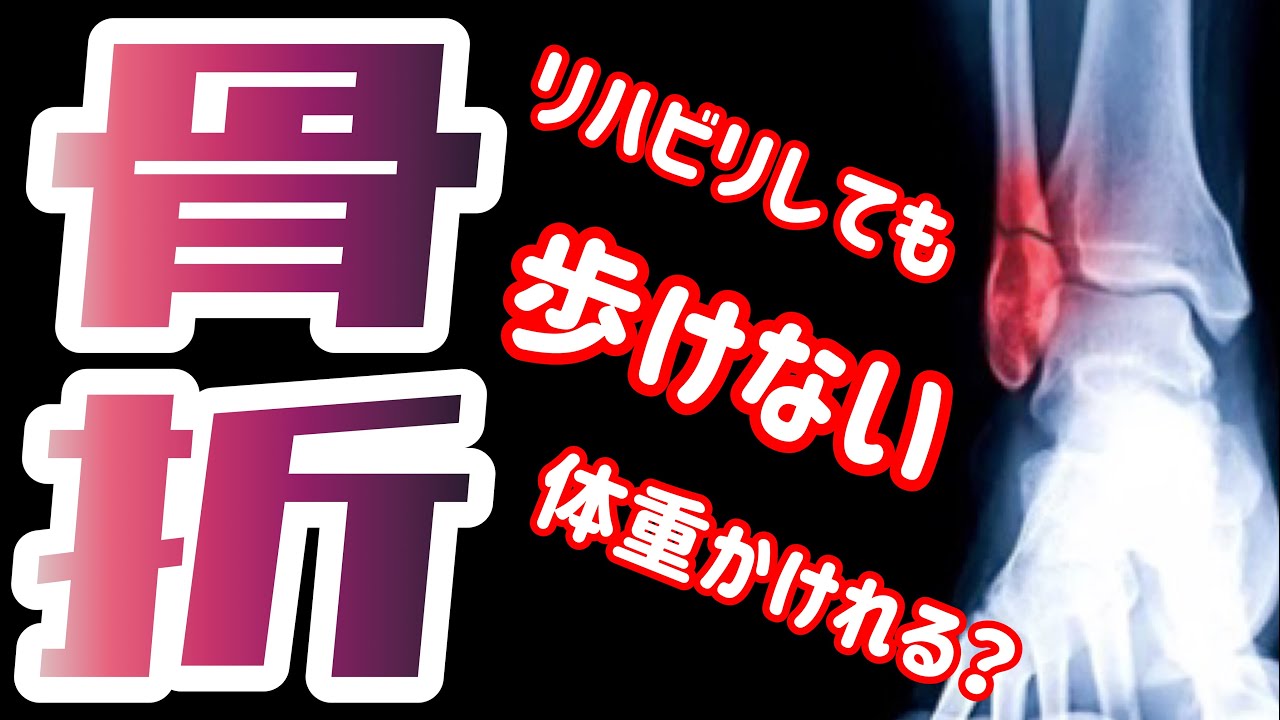 【足首骨折を早く治す方法】リハビリしても歩けない？体重の掛け方を解説！